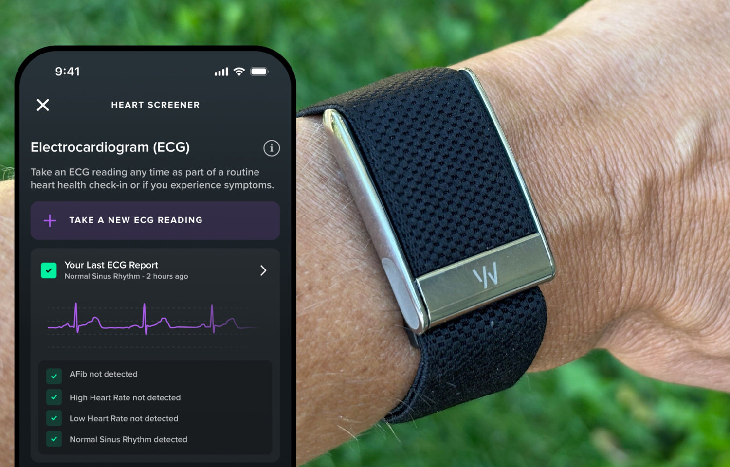 Whoop MG review: fitness tracking meets medical-grade heart insights